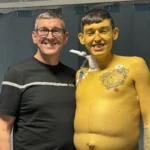 Cheshire man turns bright yellow ‘like Bart Simpson’ due to rare, life-threatening disease
