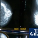 GPs’ breast cancer guidelines ‘miss’ 95% of women who will develop disease