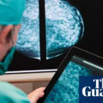 AI will help find cure for cancer ‘within our lifetimes’, says Arm Holdings chief