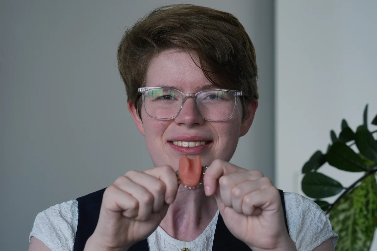Cancer survivor who was left with speech problems given artificial tongue in NHS first